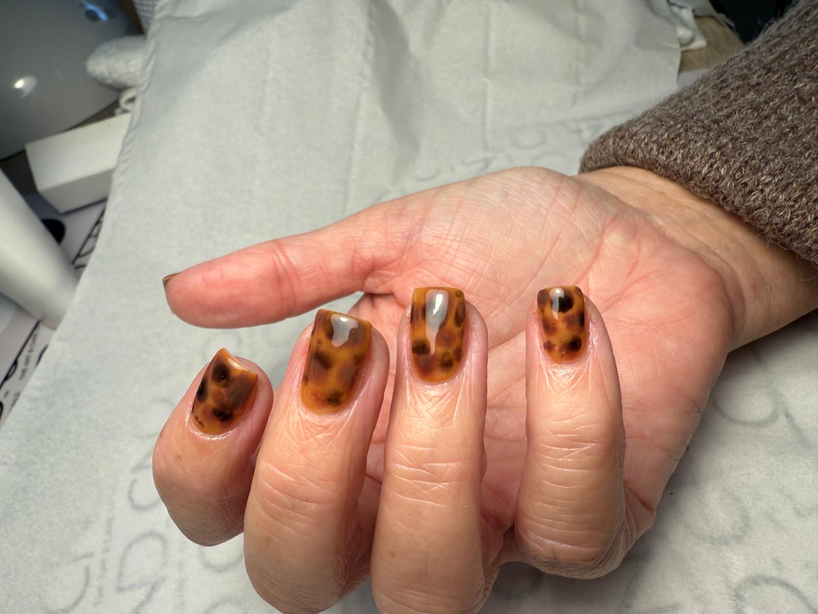 Nail treatment results